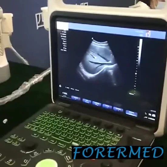 Escáner de ultrasonido veterinario portátil para animales fetales para abdomen y embarazo