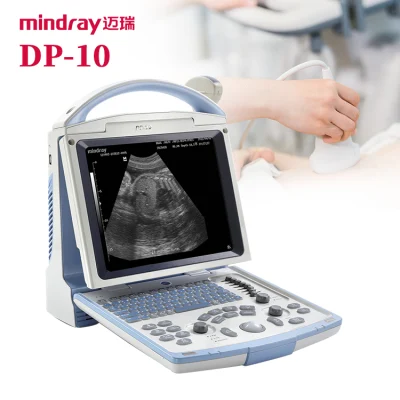 Sistema ultrasónico portátil del ecografo de la máquina del ultrasonido de Mindray Dp10